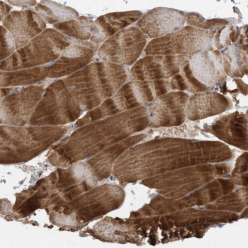 LRPPRC Antibody - BSA Free Immunohistochemistry-Paraffin: LRPPRC Antibody - BSA Free [NBP1-83349]