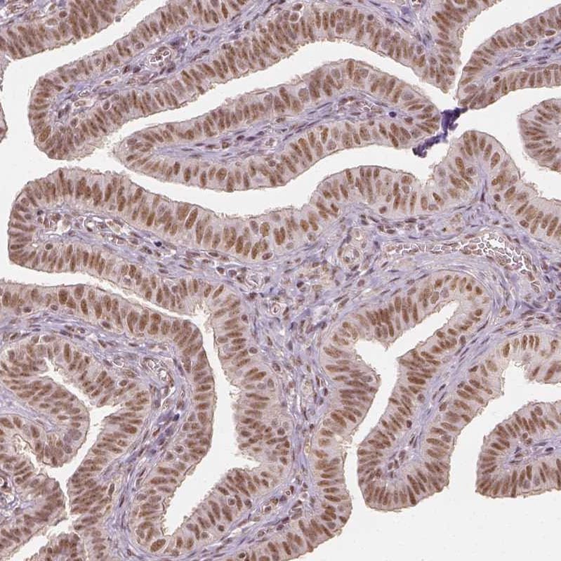HDAC1 Antibody - BSA Free Immunohistochemistry-Paraffin: HDAC1 Antibody - BSA Free [NBP1-83350]