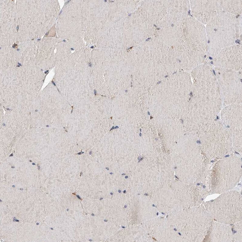 GMDS Antibody - BSA Free Immunohistochemistry-Paraffin: GMDS Antibody - BSA Free [NBP1-83357]