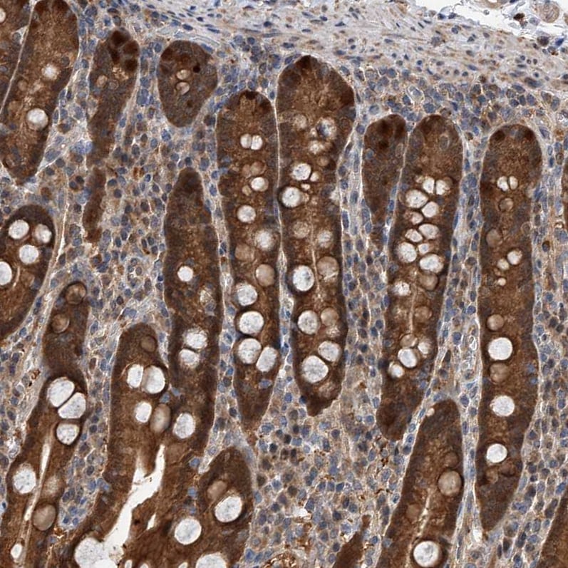 GMDS Antibody - BSA Free Immunohistochemistry-Paraffin: GMDS Antibody - BSA Free [NBP1-83357]