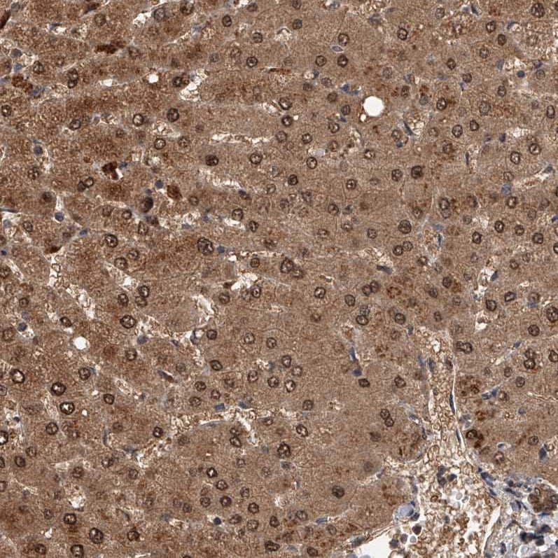 GMDS Antibody - BSA Free Immunohistochemistry-Paraffin: GMDS Antibody - BSA Free [NBP1-83357]