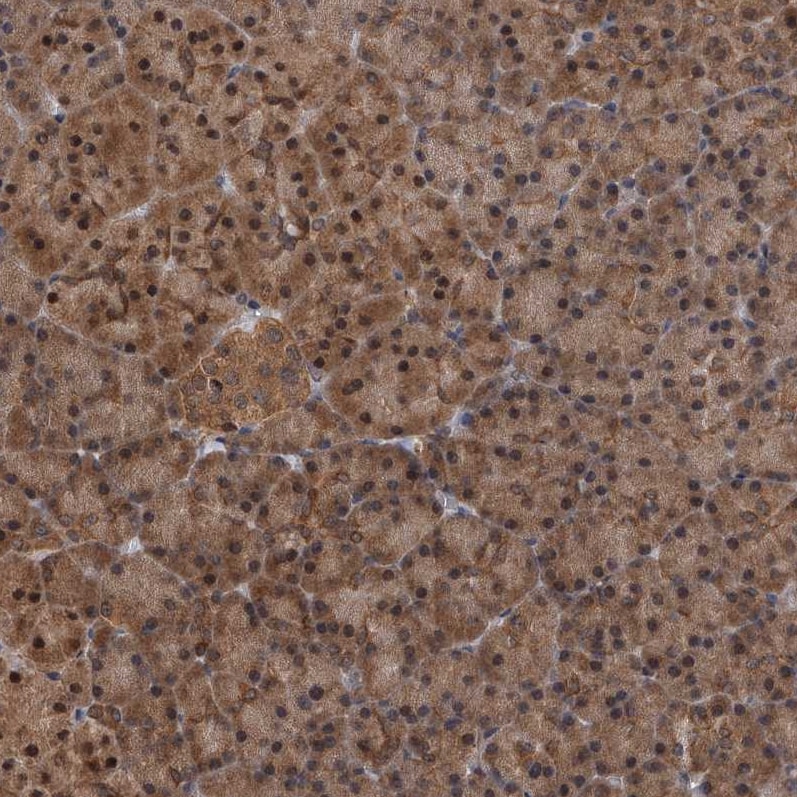 GMDS Antibody - BSA Free Immunohistochemistry-Paraffin: GMDS Antibody - BSA Free [NBP1-83357]