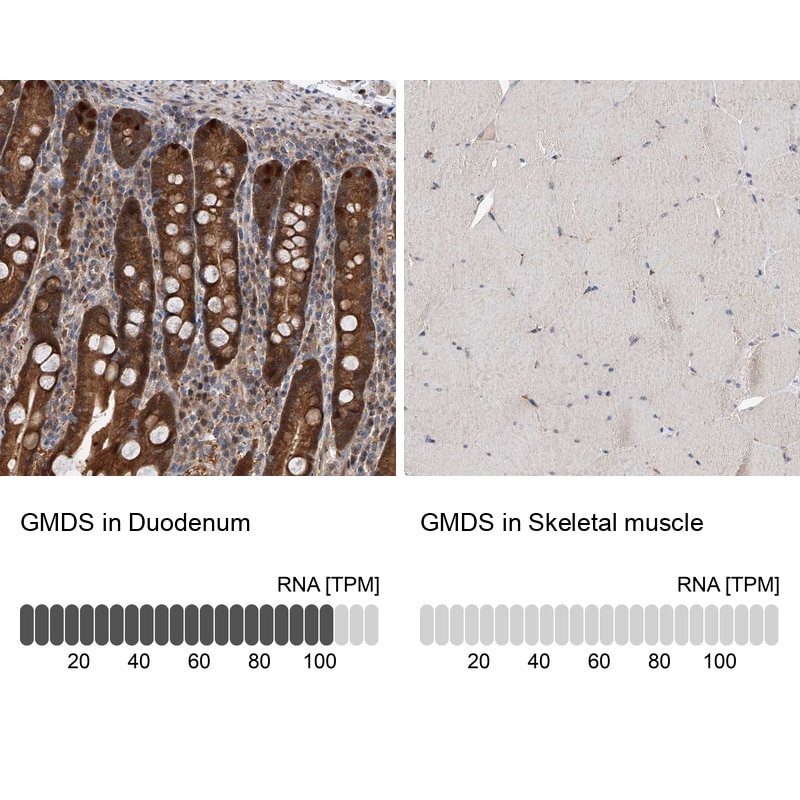GMDS Antibody - BSA Free Immunohistochemistry-Paraffin: GMDS Antibody - BSA Free [NBP1-83357]