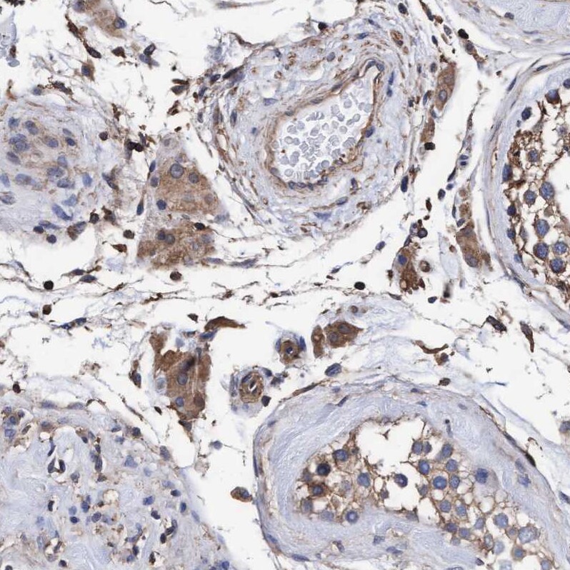 GRHPR Antibody - BSA Free Immunohistochemistry-Paraffin: GRHPR Antibody - BSA Free [NBP1-83359]
