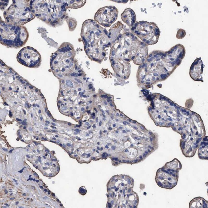 GRHPR Antibody - BSA Free Immunohistochemistry-Paraffin: GRHPR Antibody - BSA Free [NBP1-83359]