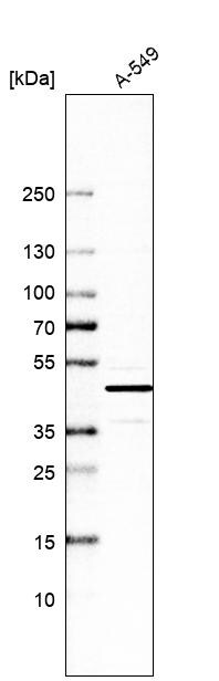 GRHPR Antibody - BSA Free Western Blot: GRHPR Antibody - BSA Free [NBP1-83359]