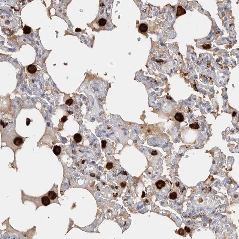 GILT/IFI30 Antibody - BSA Free Immunohistochemistry-Paraffin: GILT/IFI30 Antibody - BSA Free [NBP1-83366]