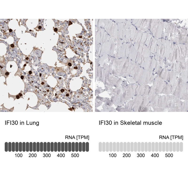 GILT/IFI30 Antibody - BSA Free Immunohistochemistry-Paraffin: GILT/IFI30 Antibody - BSA Free [NBP1-83366]