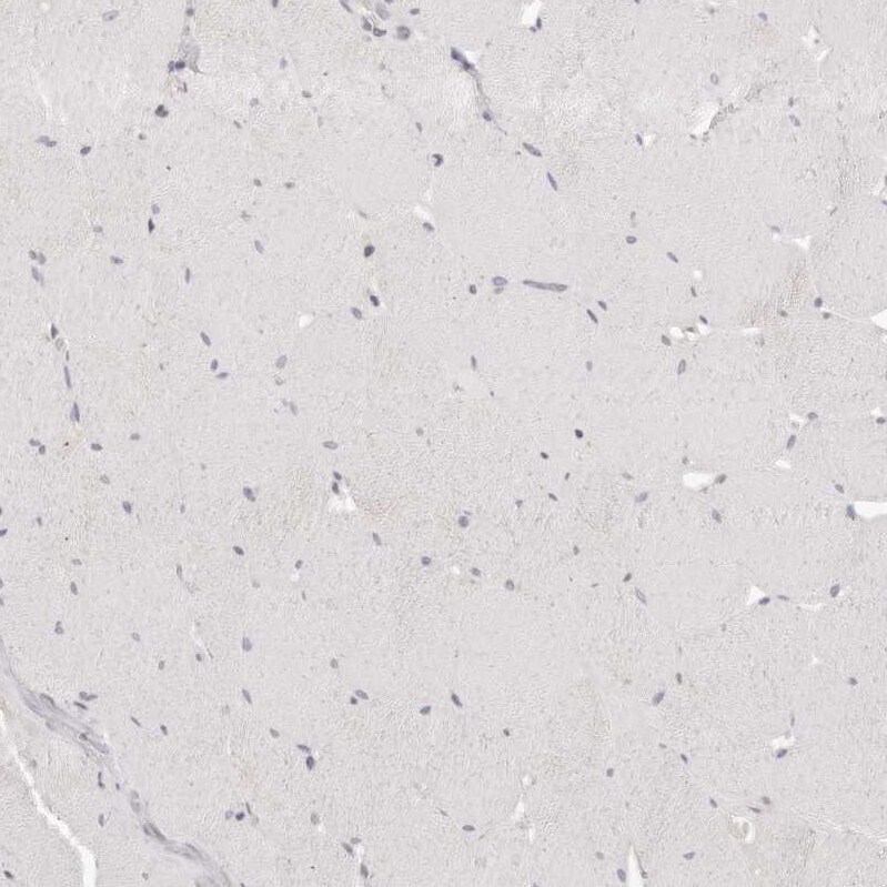 GGPS1 Antibody - BSA Free Immunohistochemistry-Paraffin: GGPS1 Antibody - BSA Free [NBP1-83368]