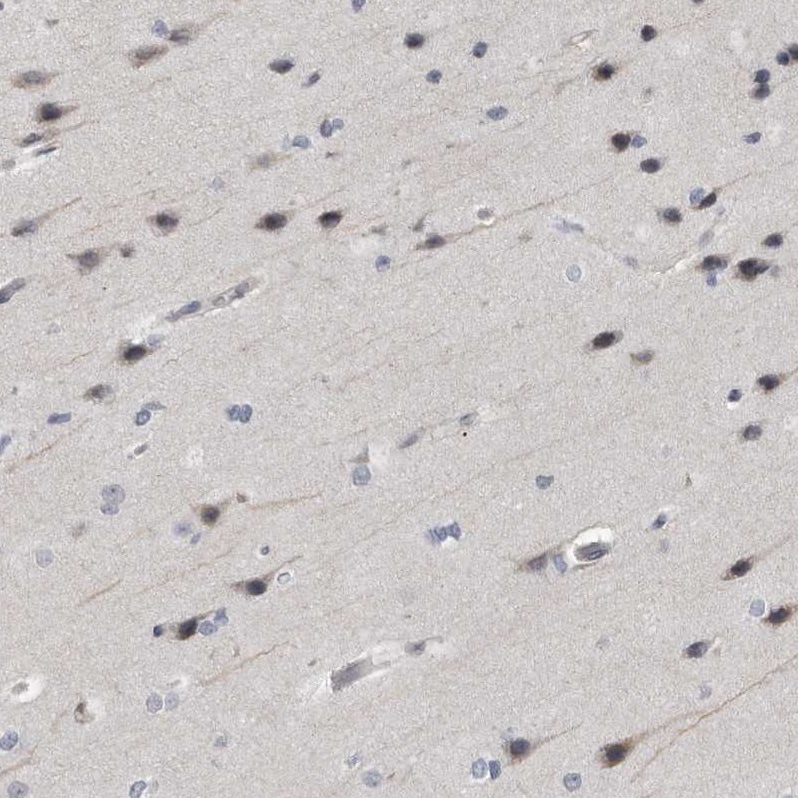 ARHGEF10 Antibody - BSA Free Immunohistochemistry-Paraffin: ARHGEF10 Antibody - BSA Free [NBP1-83373]