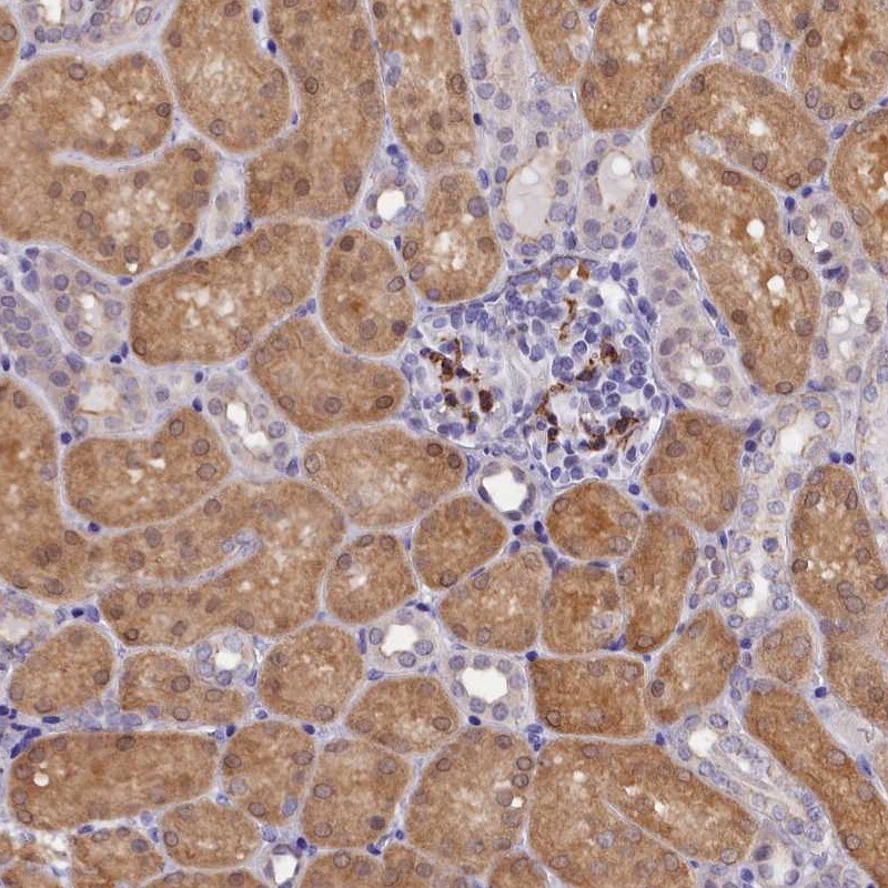 OSGEP Antibody - BSA Free Immunohistochemistry-Paraffin: OSGEP Antibody [NBP1-83378]
