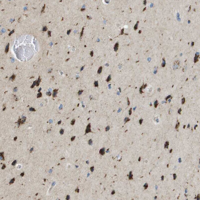 ACBD3 Antibody - BSA Free Immunohistochemistry-Paraffin: ACBD3 Antibody - BSA Free [NBP1-83379]