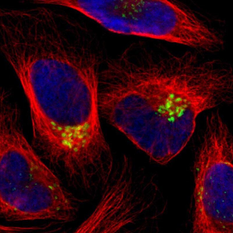 GALNT2 Antibody - BSA Free Immunocytochemistry/ Immunofluorescence: GALNT2 Antibody [NBP1-83394]