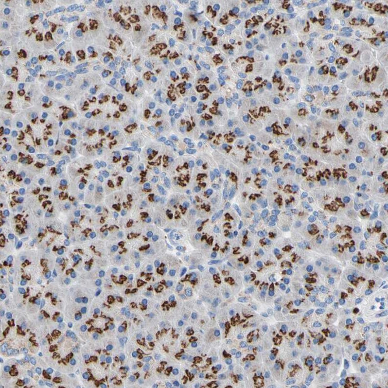 GALNT2 Antibody - BSA Free Immunohistochemistry-Paraffin: GALNT2 Antibody - BSA Free [NBP1-83394]
