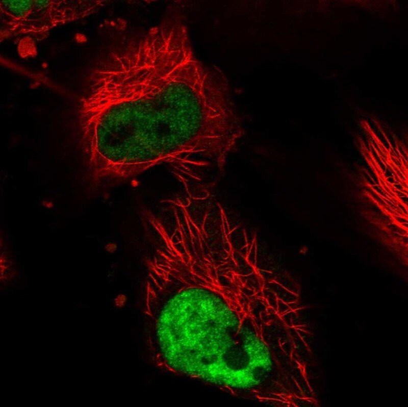 DDX5 Antibody - BSA Free Immunocytochemistry/ Immunofluorescence: DDX5 Antibody - BSA Free [NBP1-83406]