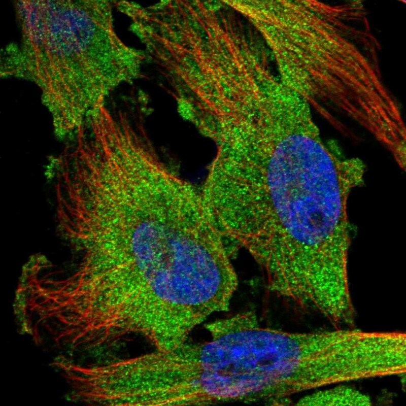 TSTA3 Antibody - BSA Free Immunocytochemistry/ Immunofluorescence: TSTA3 Antibody [NBP1-83408]