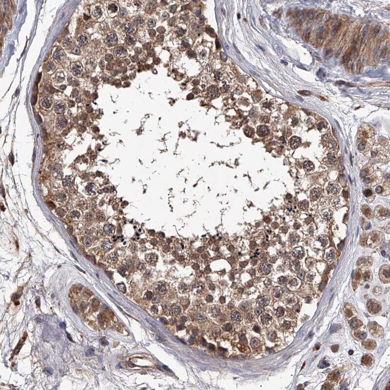 STK36 Antibody - BSA Free Immunohistochemistry: STK36 Antibody - BSA Free [NBP1-83410]
