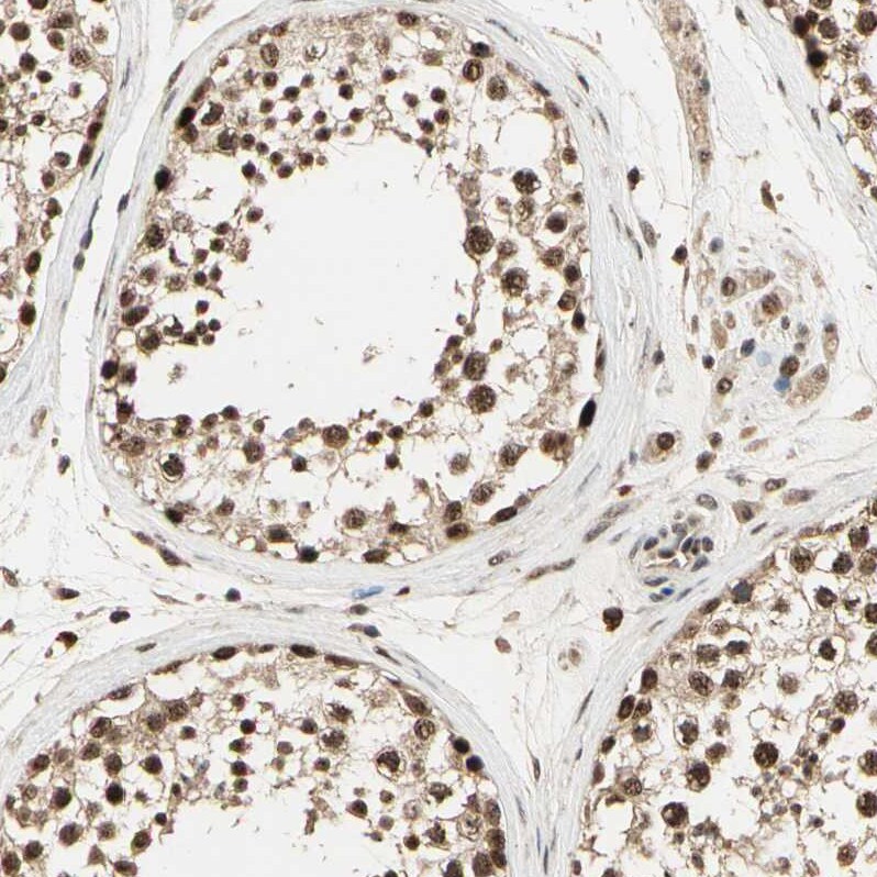 RBM25 Antibody - BSA Free Immunohistochemistry-Paraffin: RBM25 Antibody [NBP1-83418]