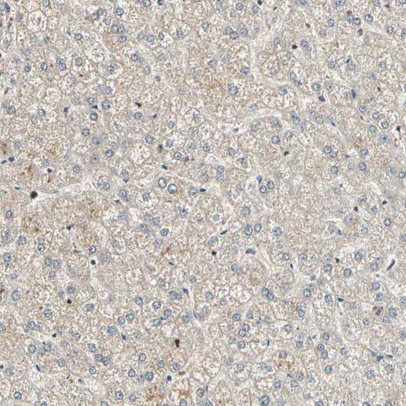 RBM25 Antibody - BSA Free Immunohistochemistry-Paraffin: RBM25 Antibody [NBP1-83418]