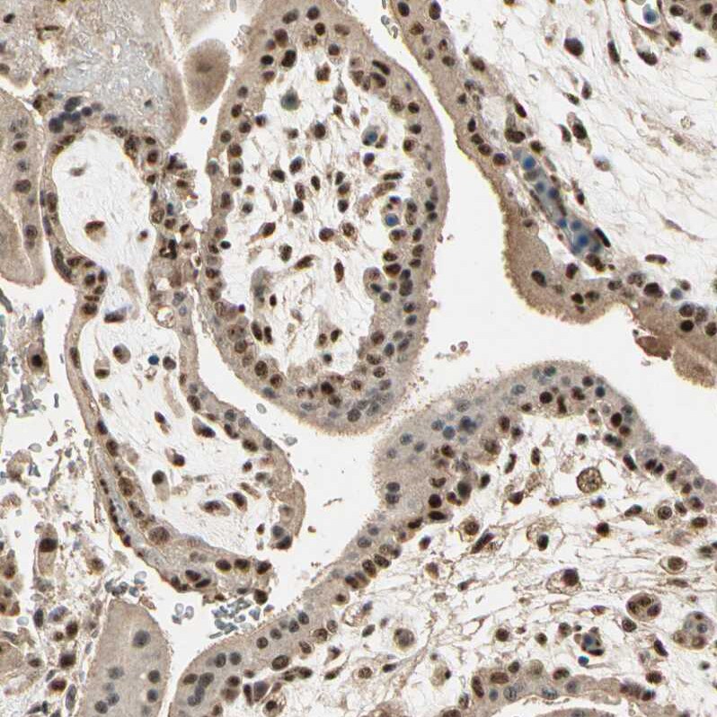 RBM25 Antibody - BSA Free Immunohistochemistry-Paraffin: RBM25 Antibody [NBP1-83418]