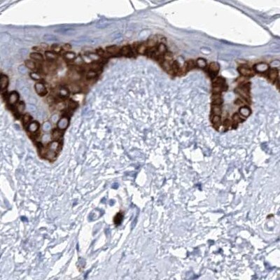 FRS3 Antibody - BSA Free Immunohistochemistry-Paraffin: FRS3 Antibody [NBP1-83420]