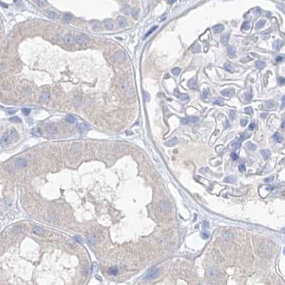 FRS3 Antibody - BSA Free Immunohistochemistry-Paraffin: FRS3 Antibody [NBP1-83420]
