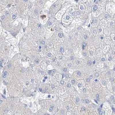FRS3 Antibody - BSA Free Immunohistochemistry-Paraffin: FRS3 Antibody [NBP1-83420]