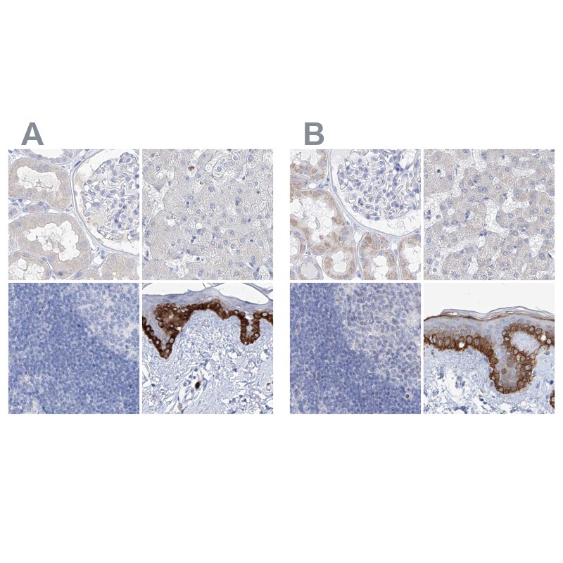 FRS3 Antibody - BSA Free Immunohistochemistry-Paraffin: FRS3 Antibody [NBP1-83420]