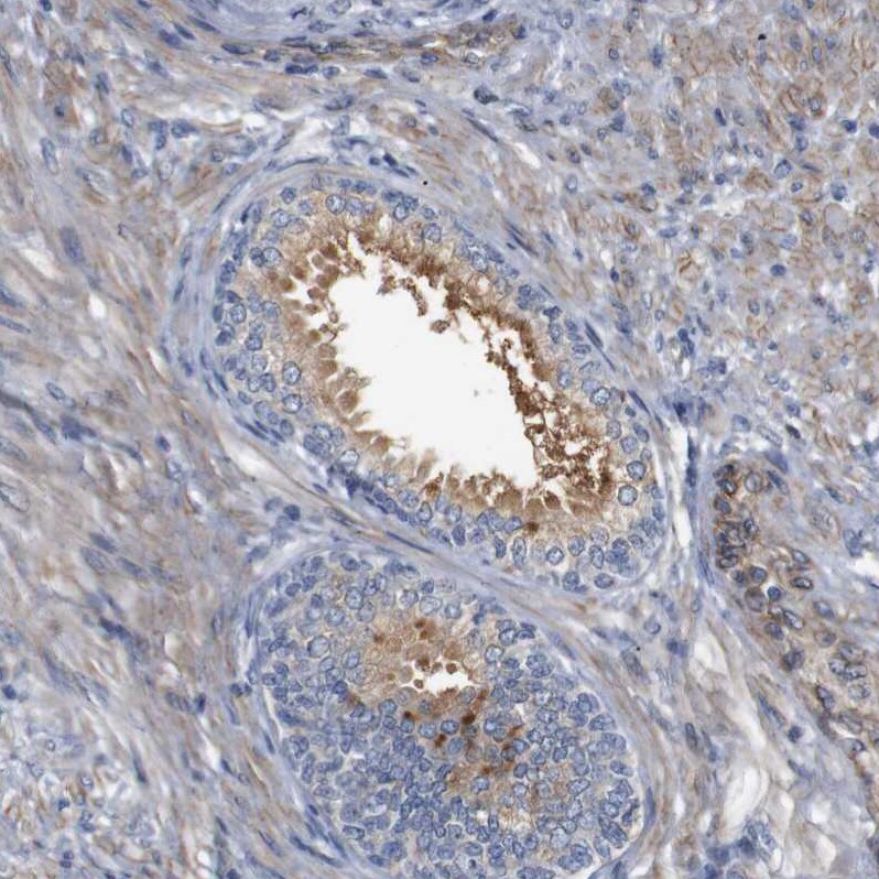 CYB561 Antibody - BSA Free Immunohistochemistry-Paraffin: CYB561 Antibody - BSA Free [NBP1-83422]
