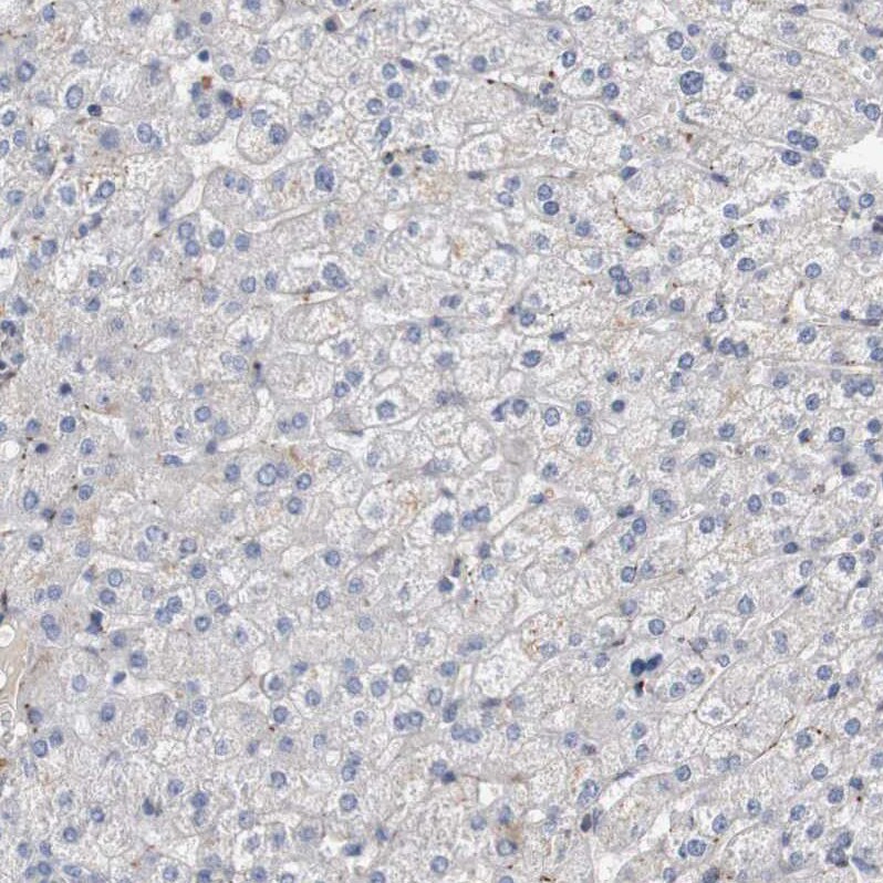 CYB561 Antibody - BSA Free Immunohistochemistry-Paraffin: CYB561 Antibody - BSA Free [NBP1-83422]