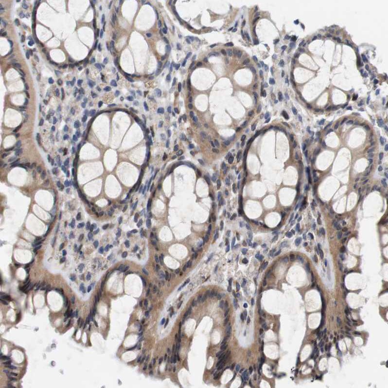 CYB561 Antibody - BSA Free Immunohistochemistry-Paraffin: CYB561 Antibody - BSA Free [NBP1-83422]