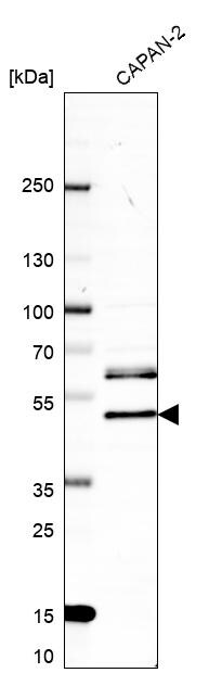Rffl Antibody - BSA Free Western Blot: Rffl Antibody - BSA Free [NBP1-83427]