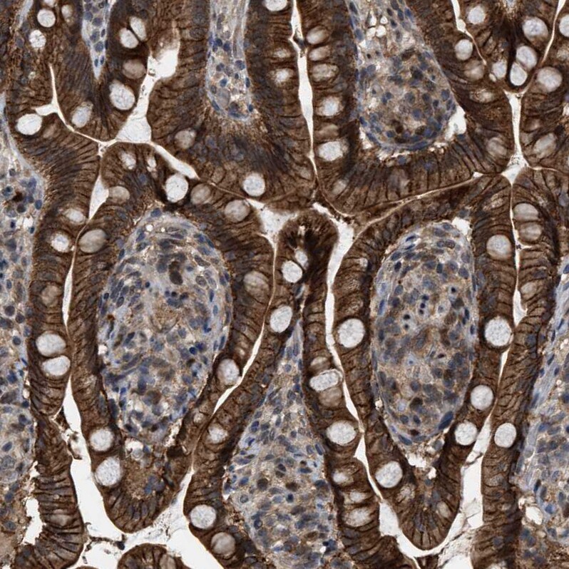 Rffl Antibody - BSA Free Immunohistochemistry-Paraffin: Rffl Antibody - BSA Free [NBP1-83427]