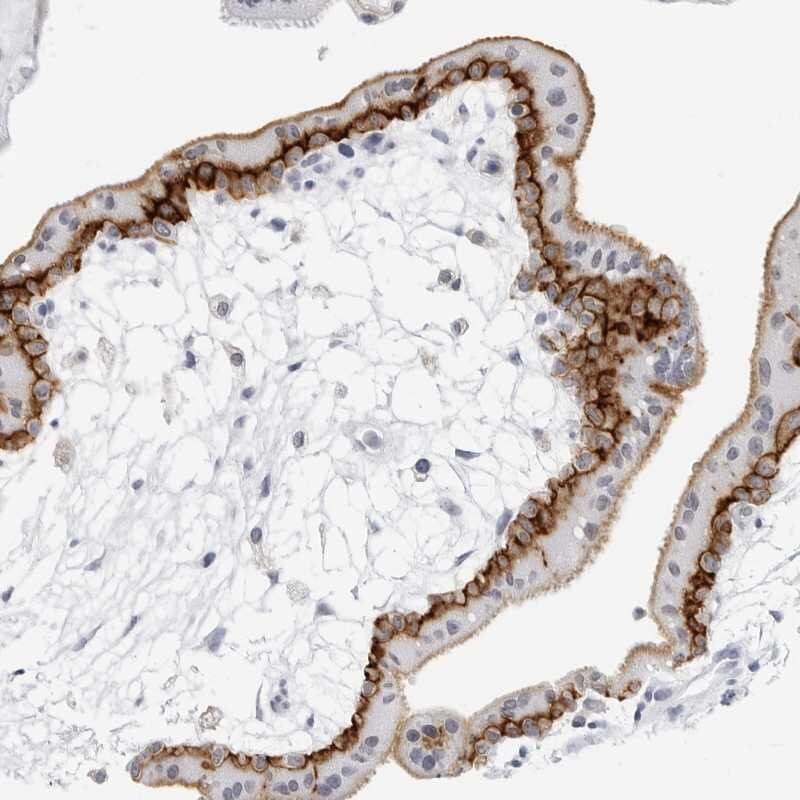 Reduced Folate Carrier/SLC19A1 Antibody - BSA Free Immunohistochemistry-Paraffin: Reduced Folate Carrier/SLC19A1 Antibody [NBP1-83430]