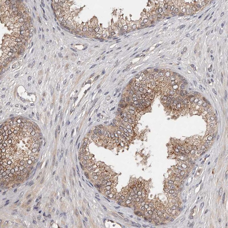 MDP1 Antibody - BSA Free Immunohistochemistry-Paraffin: MDP1 Antibody [NBP1-83431]