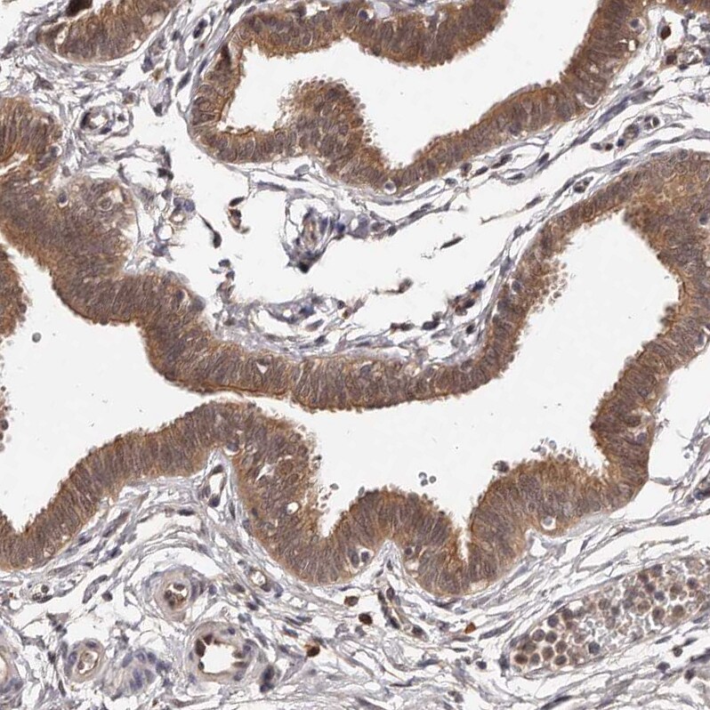 MDP1 Antibody - BSA Free Immunohistochemistry-Paraffin: MDP1 Antibody [NBP1-83431]