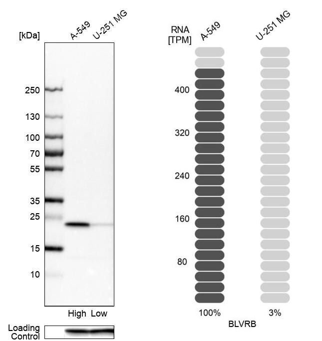Biliverdin Reductase B/BLVRB Antibody - BSA Free Western Blot: Biliverdin Reductase B/BLVRB Antibody - BSA Free [NBP1-83435]