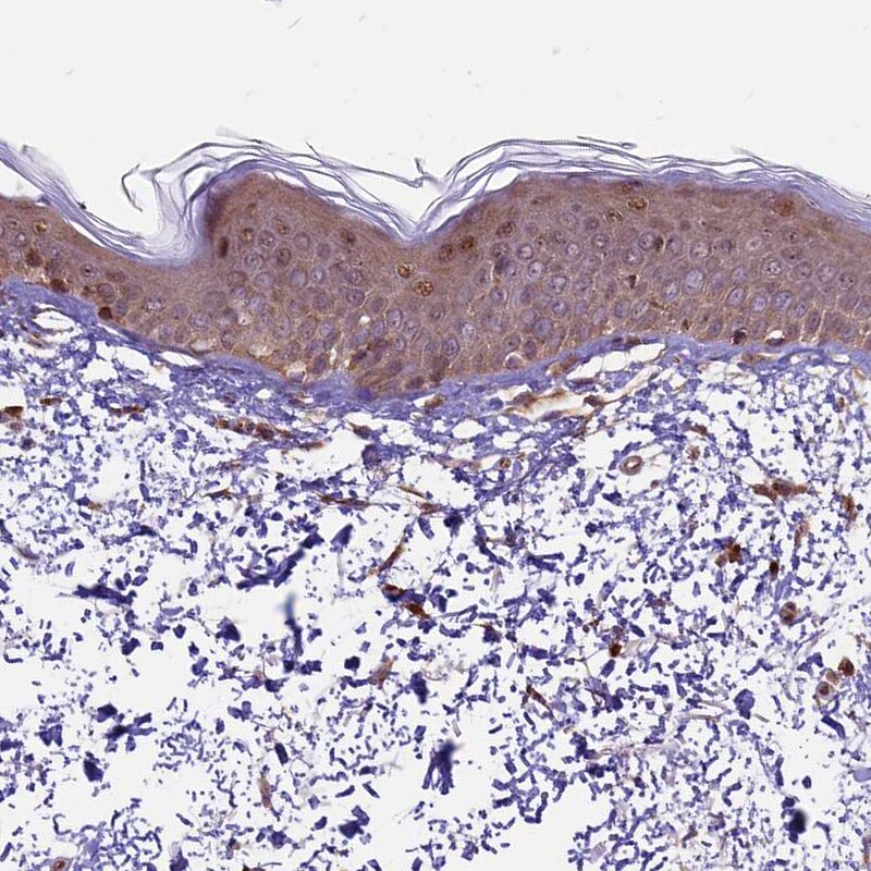 HDAC5 Antibody - BSA Free Immunohistochemistry-Paraffin: HDAC5 Antibody [NBP1-83436]