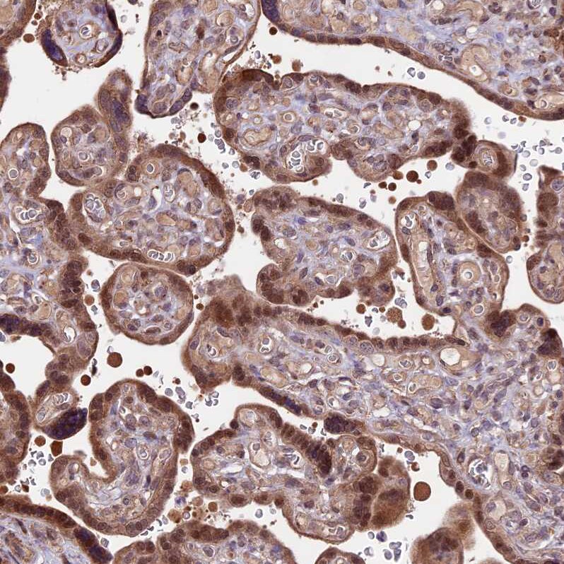 HDAC5 Antibody - BSA Free Immunohistochemistry-Paraffin: HDAC5 Antibody [NBP1-83436]