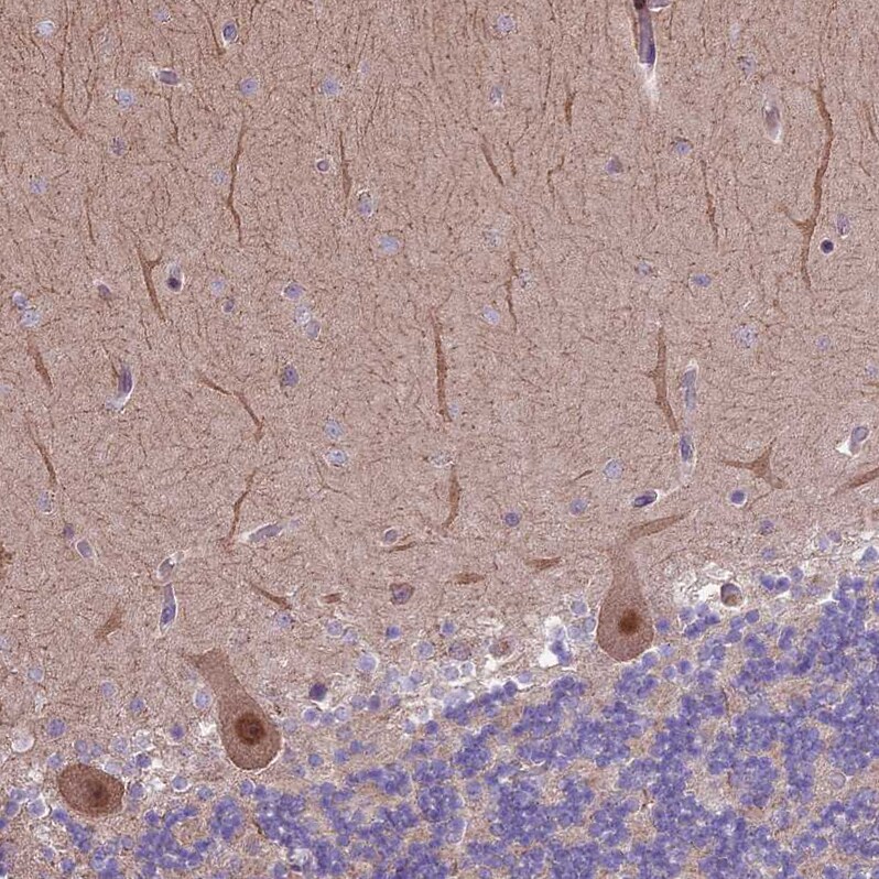 HDAC5 Antibody - BSA Free Immunohistochemistry-Paraffin: HDAC5 Antibody [NBP1-83436]