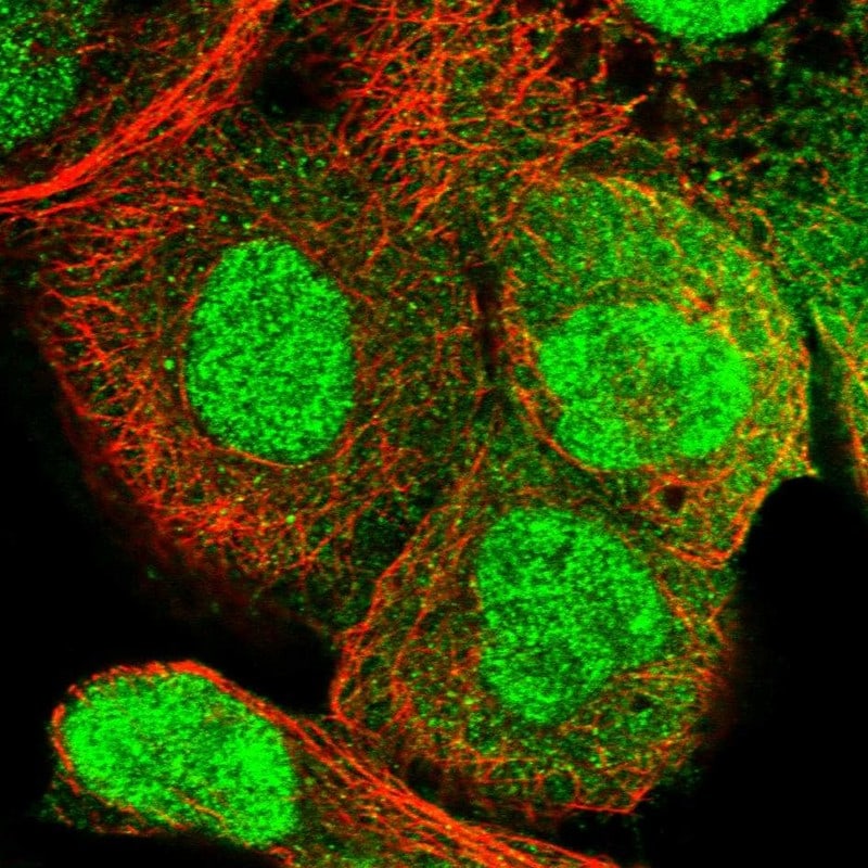 RECQL5 Antibody - BSA Free Immunocytochemistry/ Immunofluorescence: RECQL5 Antibody [NBP1-83438]