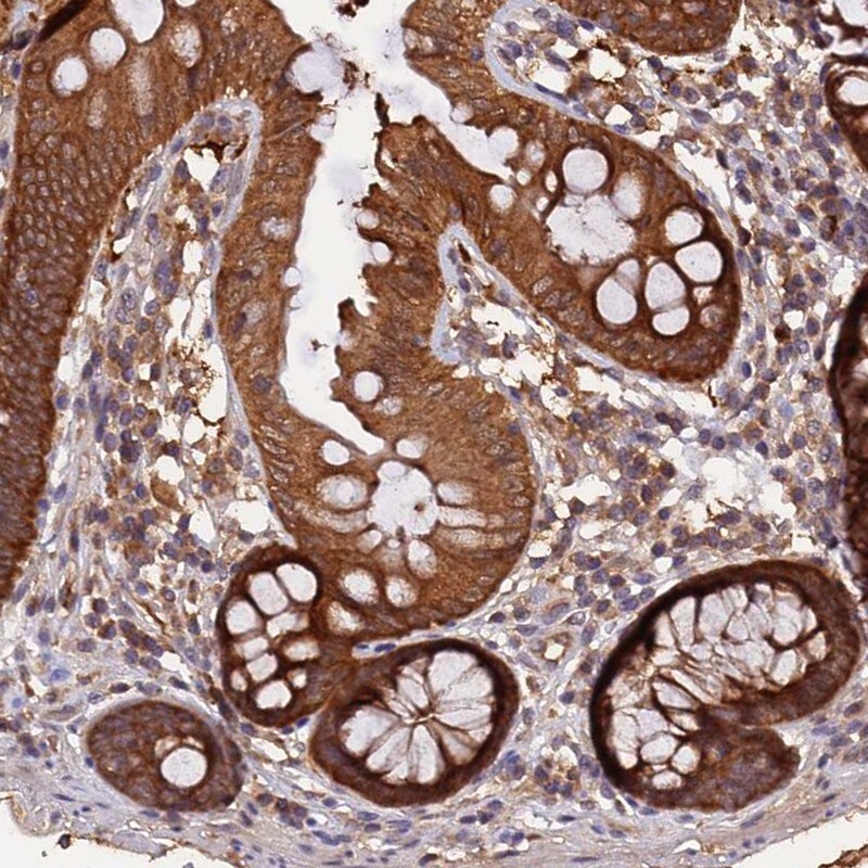 MARK4 Antibody - BSA Free Immunohistochemistry-Paraffin: MARK4 Antibody - BSA Free [NBP1-83442]