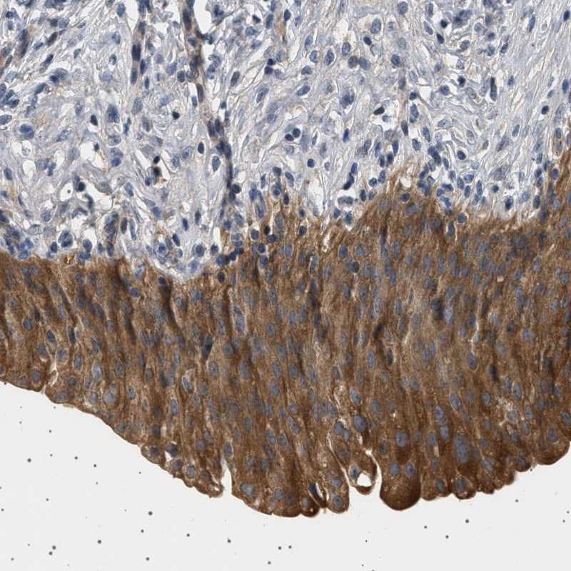 PDP1/PPAPDC2 Antibody - BSA Free Immunohistochemistry-Paraffin: PDP1/PPAPDC2 Antibody [NBP1-83443]
