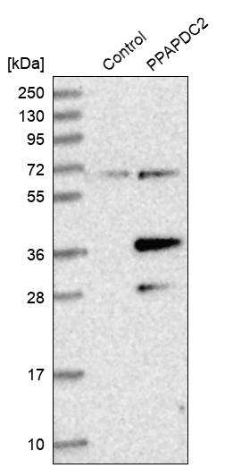 PDP1/PPAPDC2 Antibody - BSA Free Western Blot: PDP1/PPAPDC2 Antibody - BSA Free [NBP1-83443]