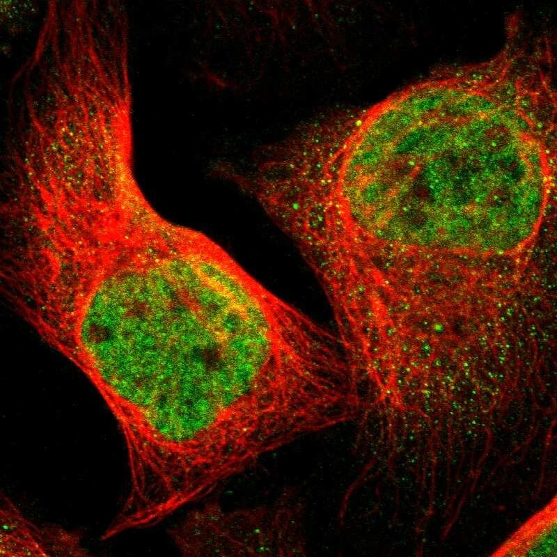 FoxP4 Antibody - BSA Free Immunocytochemistry/ Immunofluorescence: FoxP4 Antibody [NBP1-83449]