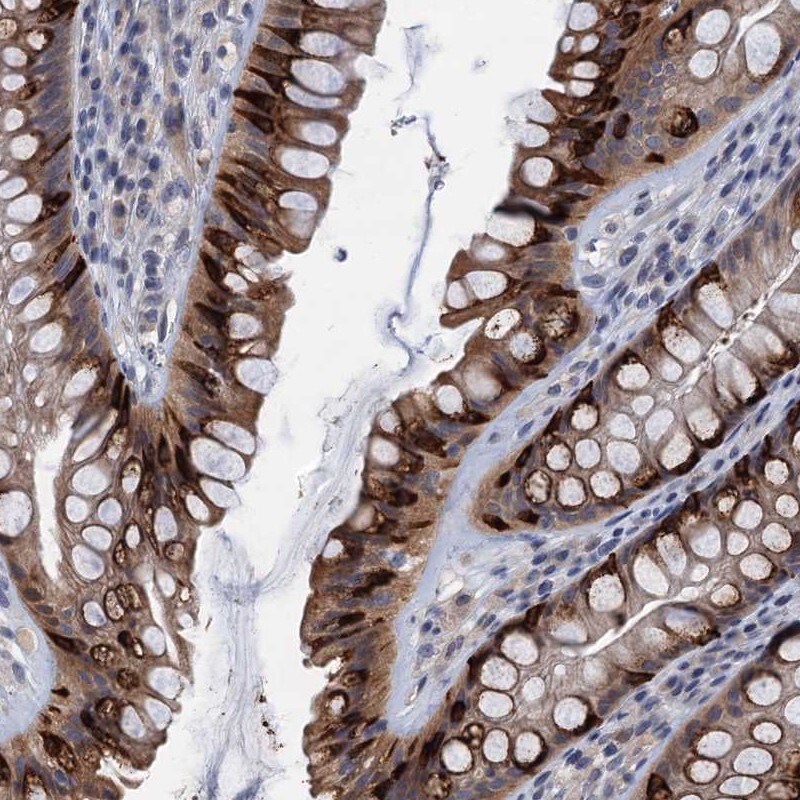 CKAP2L Antibody - BSA Free Immunohistochemistry: CKAP2L Antibody - BSA Free [NBP1-83451]