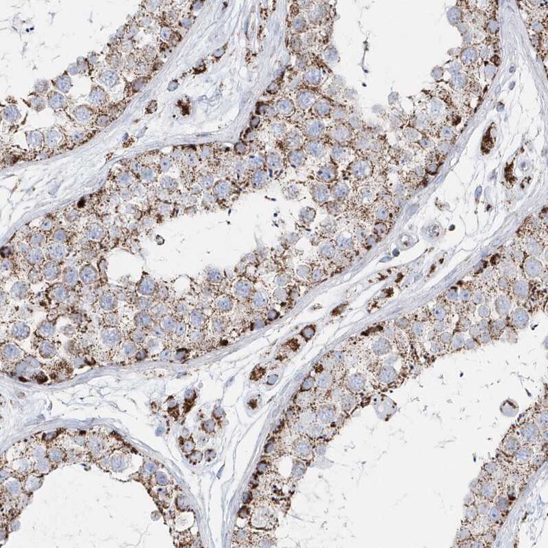 TMCO6 Antibody - BSA Free Immunohistochemistry-Paraffin: TMCO6 Antibody [NBP1-83463]