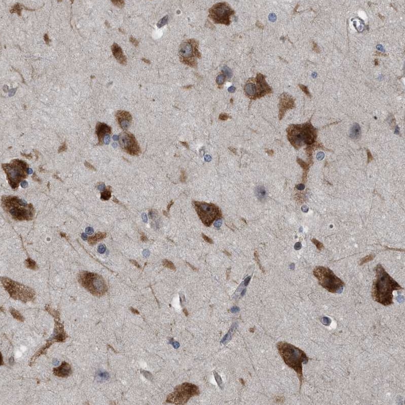GPRASP2 Antibody - BSA Free Immunohistochemistry-Paraffin: GPRASP2 Antibody - BSA Free [NBP1-83480]