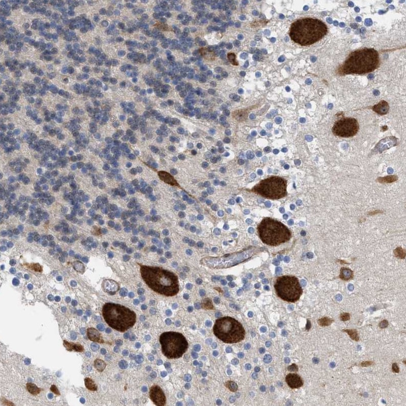 GPRASP2 Antibody - BSA Free Immunohistochemistry-Paraffin: GPRASP2 Antibody - BSA Free [NBP1-83480]