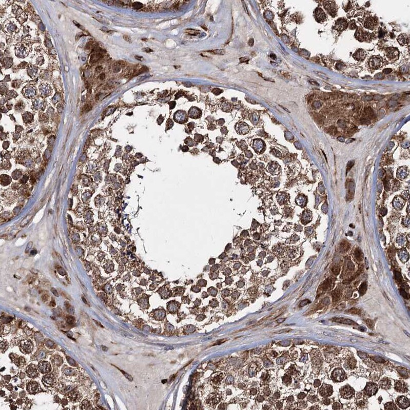 HECTD2 Antibody - BSA Free Immunohistochemistry-Paraffin: HECTD2 Antibody [NBP1-83481]